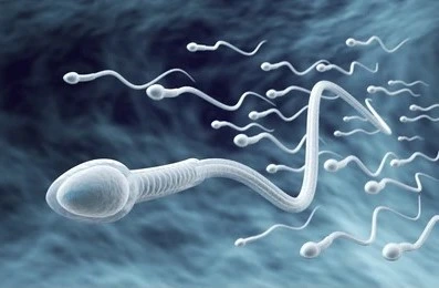 IUI